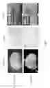 Fig. 08 - USE OF MICROPARTICLES AND ENDOTHELIAL CELLS WITH DECELLULARIZED ORGANS AND TISSUES