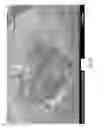 Fig. 11 - USE OF MICROPARTICLES AND ENDOTHELIAL CELLS WITH DECELLULARIZED ORGANS AND TISSUES