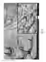 Fig. 12 - USE OF MICROPARTICLES AND ENDOTHELIAL CELLS WITH DECELLULARIZED ORGANS AND TISSUES