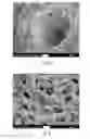 Fig. 03 - Use of perfusion decellularized liver for islet cell recellularization