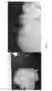 Fig. 04 - Use of perfusion decellularized liver for islet cell recellularization