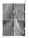 Fig. 05 - Use of perfusion decellularized liver for islet cell recellularization