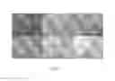 Fig. 06 - Allografts combined with tissue derived stem cells for bone healing