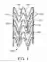 Fig. 02 - Stent with preferential coating