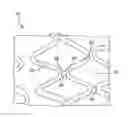 Fig. 01 - Welded stent with radiopaque material localized at the welds and methods