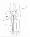 Fig. 01 - System and method to increase the overall diameter of veins
