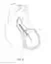 Fig. 05 - CATHETER PUMP ASSEMBLY INCLUDING A STATOR