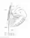 Fig. 01 - Heart help device, system, and method