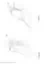Fig. 19 - Manually operable portable infusion device