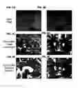 Fig. 05 - METHOD OF TREATING COGNITIVE DISORDERS USING NEUROMODULATION