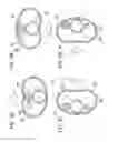 Fig. 04 - Catheter