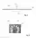 Fig. 03 - INSERTION ELEMENT FOR MEDICAL IMPLANT INSERTION DEVICE