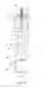 Fig. 06 - Apparatus for making a catheter