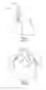 Fig. 02 - RIFLED CATHETERS AND VASCULAR ACCESS SYSTEMS