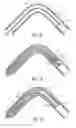 Fig. 07 - Opening system for improving catheter delivery