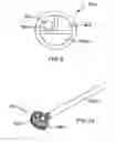 Fig. 08 - Devices and methods for perfusing an organ