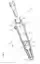 Fig. 04 - Systems and methods to compensate for compression forces in an intravascular device