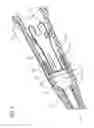 Fig. 06 - Systems and methods to compensate for compression forces in an intravascular device