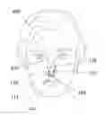 Fig. 01 - NOSE BLEED TREATMENT SYSTEM