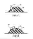 Fig. 03 - METHOD AND APPARATUS FOR WOUND DRESSING