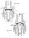 Fig. 12 - Transfer device valve