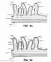 Fig. 06 - Pacing leads with a structured coating