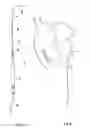 Fig. 02 - Myocardial heart pacemaker electrode