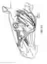 Fig. 04 - Method for modifying larynx position by trans-positioning muscle and electrode stimulation