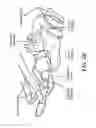 Fig. 05 - Method for modifying larynx position by trans-positioning muscle and electrode stimulation