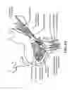 Fig. 07 - Method for modifying larynx position by trans-positioning muscle and electrode stimulation