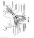 Fig. 08 - Method for modifying larynx position by trans-positioning muscle and electrode stimulation