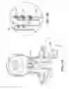 Fig. 15 - Method for modifying larynx position by trans-positioning muscle and electrode stimulation