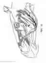 Fig. 17 - Method for modifying larynx position by trans-positioning muscle and electrode stimulation