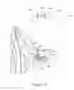 Fig. 13 - Methods for treatment of sleep apnea