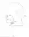 Fig. 03 - Devices for treatment of sleep apnea