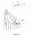 Fig. 13 - Devices for treatment of sleep apnea