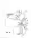 Fig. 16 - Devices for treatment of sleep apnea