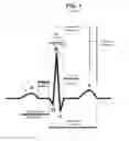 Fig. 02 - System and method for stimulating the heart via storage of multi-waveforms in a cardiac stimulation device