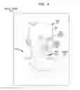 Fig. 06 - Tonal deafness compensation in an auditory prosthesis system