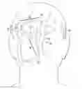 Fig. 01 - Surgical method for implantable head mounted neurostimulation system for head pain