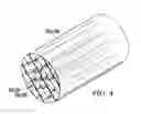 Fig. 04 - Surgical method for implantable head mounted neurostimulation system for head pain