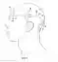Fig. 06 - Surgical method for implantable head mounted neurostimulation system for head pain