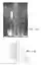 Fig. 10 - High density epidural stimulation for facilitation of locomotion, posture, voluntary movement, and recovery of autonomic, sexual, vasomotor, and cognitive function after neurological injury