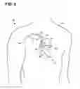 Fig. 10 - Systems and methods for evaluating cardiac therapy