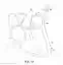 Fig. 02 - Leadless cardiac pacemaker system for usage in combination with an implantable cardioverter-defibrillator