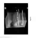 Fig. 06 - System and Method for Improved High Dose Radiation Therapy Treatment Planning