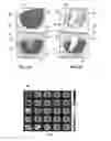 Fig. 03 - METHOD AND DEVICE FOR FAST RASTER BEAM SCANNING IN INTENSITY-MODULATED ION BEAM THERAPY