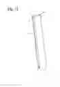 Fig. 02 - Device for standard preparation of urinary sediment for urine analysis (Mono system)