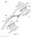 Fig. 15 - Alignment tool