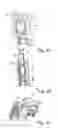 Fig. 04 - Apparatus and method for discharge and comminution of a chip